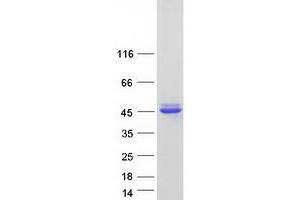 Validation with Western Blot