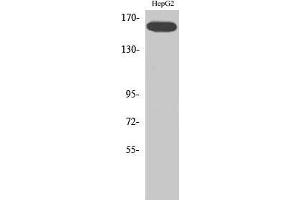 Western Blot (WB) analysis of specific cells using Phospho-Flk-1 (Y1214) Polyclonal Antibody. (VEGFR2/CD309 anticorps  (pTyr1214))