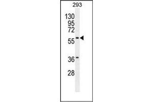 Western blot analysis of Carboxypeptidase A2 Antibody  in 293 cell line lysates (35ug/lane).