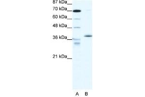 Western Blotting (WB) image for anti-Nuclear Receptor Subfamily 2, Group F, Member 6 (NR2F6) (N-Term) antibody (ABIN182517) (NR2F6 anticorps  (N-Term))