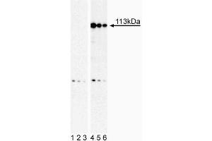Western Blot analysis of Stat2 (pY690) in human histiocytic lymphoma. (STAT2 anticorps  (pTyr690))