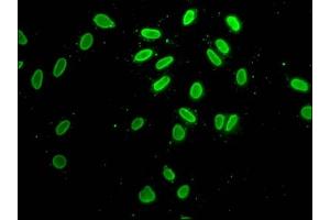Immunofluorescence staining of Hela cells with ABIN7139193 at 1:25, counter-stained with DAPI. (H2AFZ anticorps  (acLys7))