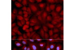 Immunofluorescence analysis of U2OS cells using SNCG Polyclonal Antibody (SNCG anticorps)
