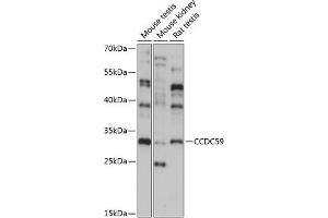 Western blot analysis of extracts of various cell lines, using CCDC59 antibody (ABIN7266440) at 1:1000 dilution.