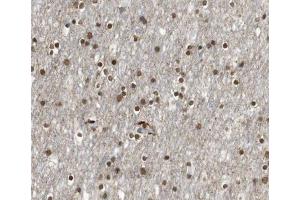 ABIN6266531 at 1/100 staining human brain tissue sections by IHC-P.
