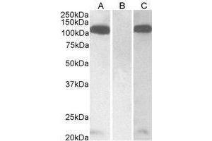 Western Blotting (WB) image for anti-Furin (Paired Basic Amino Acid Cleaving Enzyme) (FURIN) (C-Term) antibody (ABIN2473713)