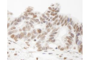 Immunohistochemistry (IHC) image for anti-Heterogeneous Nuclear Ribonucleoprotein U-Like 1 (HNRNPUL1) (AA 50-100) antibody (ABIN7448953) (HNRNPUL1 anticorps  (AA 50-100))