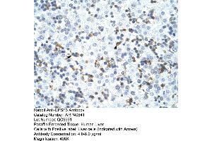 Rabbit Anti-CPSF3 Antibody  Paraffin Embedded Tissue: Human Liver Cellular Data: Liver cells Antibody Concentration: 4.