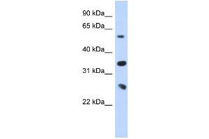 WB Suggested Anti-UBE2K Antibody Titration:  0. (UBE2K anticorps  (Middle Region))