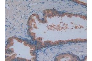 Detection of MAG in Human Prostate Gland Tissue using Polyclonal Antibody to Myelin Associated Glycoprotein (MAG) (MAG anticorps  (AA 133-237))