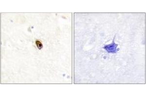 Immunohistochemistry analysis of paraffin-embedded human brain, using AurB/C (Phospho-Thr236/202) Antibody. (AurB/C anticorps  (pThr236))
