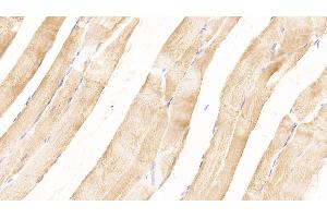 Detection of MYOG in Rat Skeletal muscle Tissue using Polyclonal Antibody to Myogenin (MYOG)