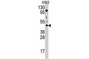 Western blot analysis of PRMT8 polyclonal antibody  in K-562 cell line lysates (35 ug/lane). (PRMT8 anticorps  (C-Term))
