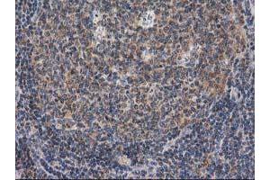 Image no. 20 for anti-Glucosidase, Beta, Acid 3 (Cytosolic) (GBA3) (AA 1-150), (AA 370-469) antibody (ABIN1490582)