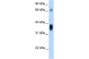 NOV antibody used at 1.