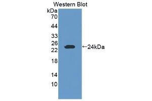 Detection of Recombinant GZMK, Mouse using Polyclonal Antibody to Granzyme K (GZMK)
