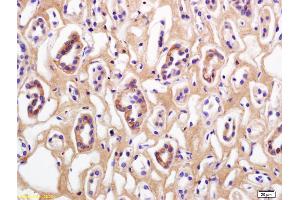 Formalin-fixed and paraffin embedded human kidney labeled with Rabbit Anti Phospho-Beta Catenin (Thr41/Ser45) Polyclonal Antibody, Unconjugated (ABIN683953) at 1:200 followed by conjugation to the secondary antibody and DAB staining