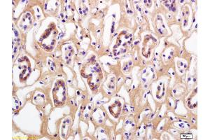 Formalin-fixed and paraffin embedded human kidney labeled with Rabbit Anti Phospho-Beta Catenin (Thr41/Ser45) Polyclonal Antibody, Unconjugated (ABIN683953) at 1:200 followed by conjugation to the secondary antibody and DAB staining (beta Catenin anticorps  (pSer45, pThr41))