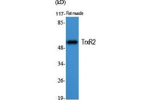 Western Blot (WB) analysis of specific cells using TrxR2 Polyclonal Antibody. (TXNRD2 anticorps  (C-Term))