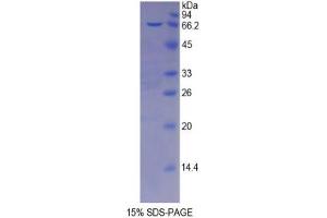 SDS-PAGE analysis of Mouse Protease, Serine 8 Protein. (Protease Protéine)