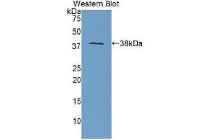 Detection of Recombinant APOH, Human using Polyclonal Antibody to Apolipoprotein H (APOH)