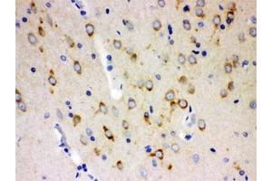 IHC testing of FFPE rat brain with SSH3BP1 antibody. (ABI1 anticorps)