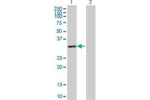 Western Blot analysis of KHK expression in transfected 293T cell line by KHK MaxPab polyclonal antibody. (Ketohexokinase anticorps  (AA 1-298))
