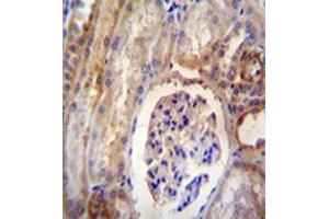 Formalin fixed, paraffin embedded human kidney tissue reacted with DYNLRB2 Antibody  followed by peroxidase conjugation of the secondary antibody and DAB staining. (DYNLRB2 anticorps  (Middle Region))