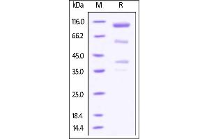 Cynomolgus Glypican 3 / GPC3, Fc Tag on SDS-PAGE under reducing (R) condition.