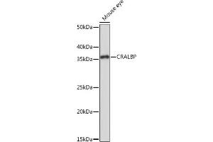 Western blot analysis of extracts of Mouse eye, using CRALBP Rabbit mAb (ABIN7269934) at 1:1000 dilution. (RLBP1 anticorps)