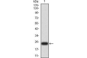 Western blot analysis using UCP3 mAb against human UCP3 (AA: 1-113 and 217-312) recombinant protein. (UCP3 anticorps  (AA 1-113, AA 217-312))