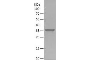 Western Blotting (WB) image for Integrin beta 5 (ITGB5) (AA 71-201) protein (His-IF2DI Tag) (ABIN7123473)