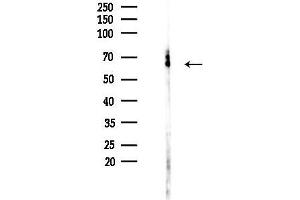 Western blot analysis of lysates from HUVEC cells(heat-shock,45 min treatment), using Paxillin Antibody at 1/1000 dilution.