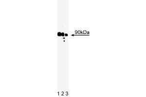 anti-Ribosomal Protein S6 Kinase, 90kDa, Polypeptide 1 (RPS6KA1) (AA 1-184) antibody