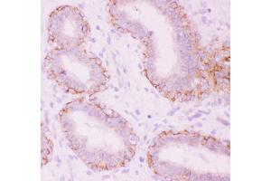 Anti-CTNNA1 Picoband antibody,  IHC(P): Human Mammary Tissue (CTNNA1 anticorps  (AA 143-292))