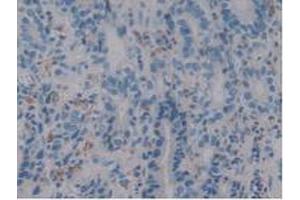 IHC-P analysis of Human Stomach Tissue, with DAB staining. (Iba1 anticorps  (AA 1-147))
