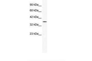 Image no. 2 for anti-Y Box Binding Protein 2 (YBX2) (AA 178-227) antibody (ABIN202349) (YBX2 anticorps  (AA 178-227))