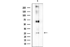 Western blot analysis of lysates from Rat brain, using OR56 Antibody at 1/1000 dilution.