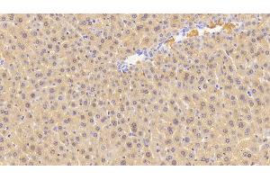 Detection of CGRP in Mouse Liver Tissue using Polyclonal Antibody to Calcitonin Gene Related Peptide (CGRP) (CGRP anticorps  (AA 1-130))