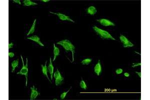 Immunofluorescence of monoclonal antibody to TPMT on HeLa cell. (TPMT anticorps  (AA 1-245))