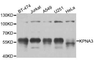 Western blot analysis of extracts of various cell lines, using KPNA3 antibody. (KPNA3 anticorps  (AA 1-210))