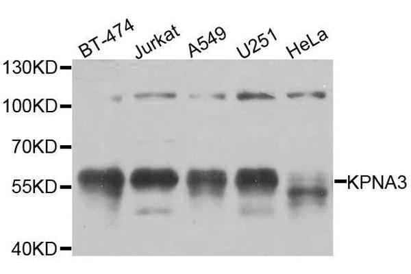 KPNA3 anticorps  (AA 1-210)