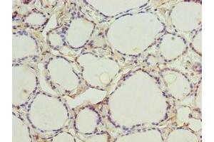 Immunohistochemistry of paraffin-embedded human thyroid tissue using ABIN7148776 at dilution of 1:100 (CMC4 anticorps  (AA 1-68))