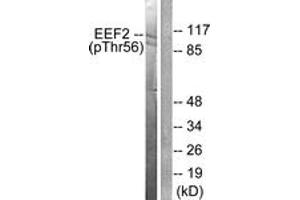 Western blot analysis of extracts from NIH-3T3 cells treated with Serum 10% 30', using eEF2 (Phospho-Thr56) Antibody. (EEF2 anticorps  (pThr56))