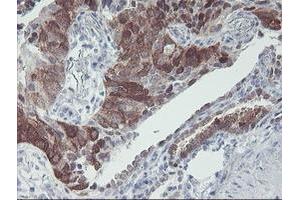 Image no. 4 for anti-Interferon Regulatory Factor 6 (IRF6) antibody (ABIN1498901)