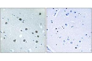 Immunohistochemistry (IHC) image for anti-Myosin ID (MYO1D) (AA 825-874) antibody (ABIN2890431) (Myosin ID anticorps  (AA 825-874))