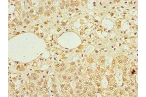 Immunohistochemistry of paraffin-embedded human adrenal gland tissue using ABIN7143883 at dilution of 1:100 (TFCP2 anticorps  (AA 1-280))