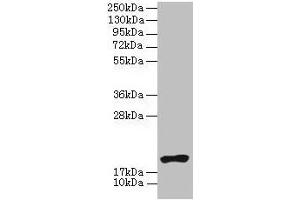 Western blot All lanes: NR2C2AP antibody at 4 μg/mL + HL60 whole cell lysate Secondary Goat polyclonal to rabbit IgG at 1/10000 dilution Predicted band size: 16, 20 kDa Observed band size: 20 kDa (NR2C2AP anticorps  (AA 7-139))