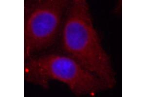 Immunofluorescence (IF) image for anti-Growth Associated Protein 43 (GAP43) (pSer41) antibody (ABIN1870201) (GAP43 anticorps  (pSer41))