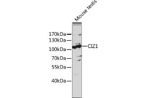 Western blot analysis of extracts of mouse testis, using CIZ1 antibody (ABIN7266237) at 1:1000 dilution. (CIZ1 anticorps  (AA 250-440))